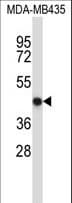 NFE2 / p45 Antibody (aa312-340)
