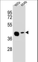 SLC35G5 / AMAC1L2 Antibody (aa1-30)