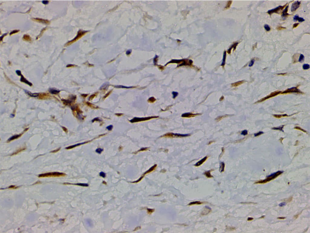 PIK3R1 / p85 Alpha Antibody (phospho-Tyr607)