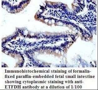 ETFDH Antibody (aa427-598)