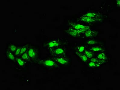 ERCC4 / XPF Antibody