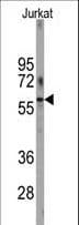 PFKFB1 Antibody (aa13-43)