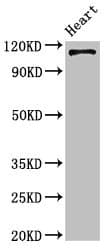 ITGA5/Integrin Alpha 5/CD49e Antibody