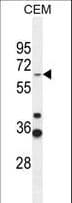ZNF667 / MIPU1 Antibody (aa303-331)