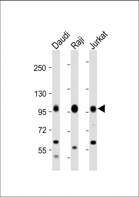 Polyclonal Rabbit anti-Human MAP4K1 / HPK1 Antibody (WB)