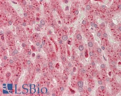 Polyclonal Rabbit anti-Rat PHKG1 Antibody (aa68-117, IHC, WB)