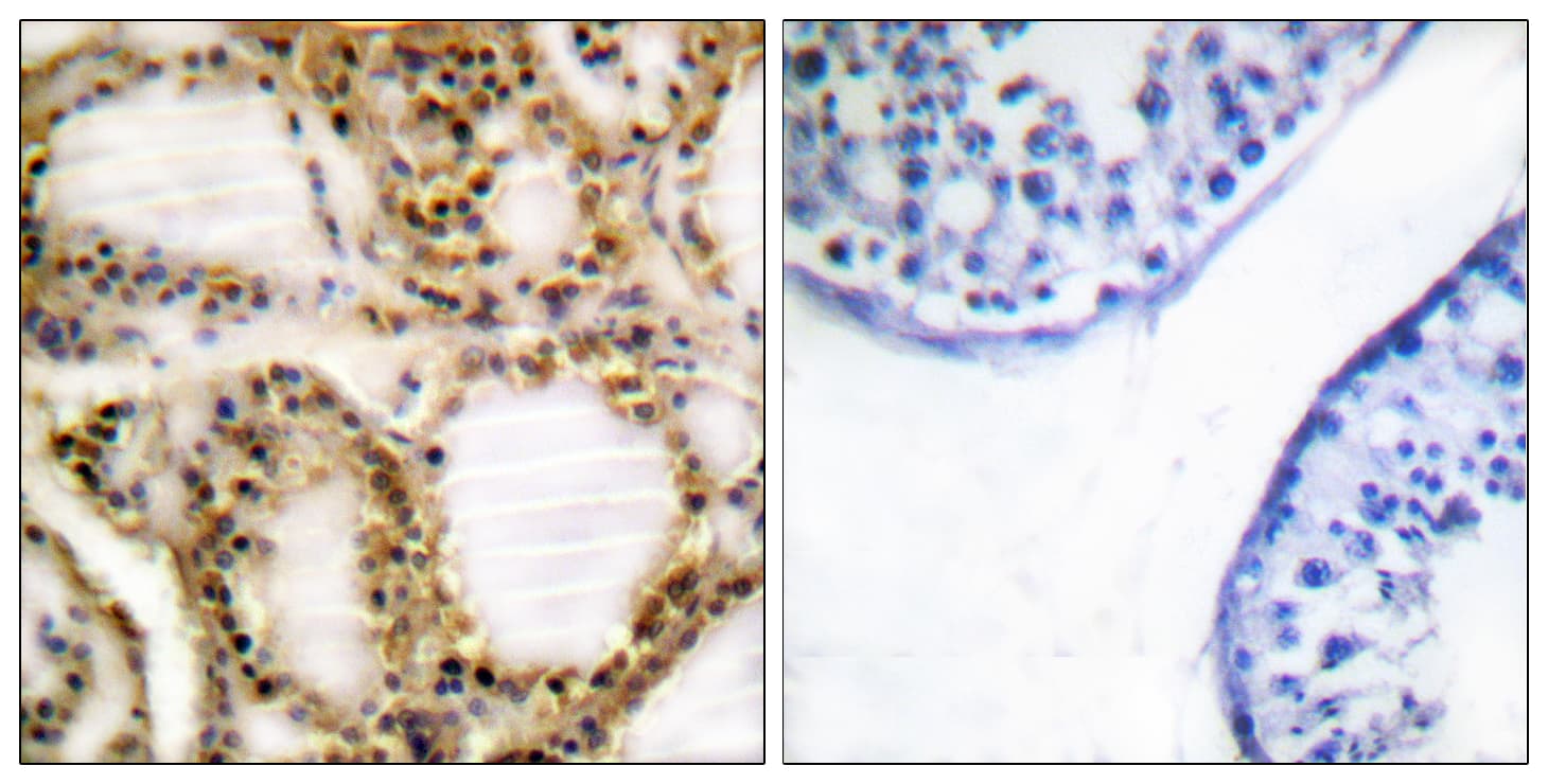 Polyclonal Rabbit anti-Human RB1 / Retinoblastoma / RB Antibody (phospho-Thr821, IHC, IF)