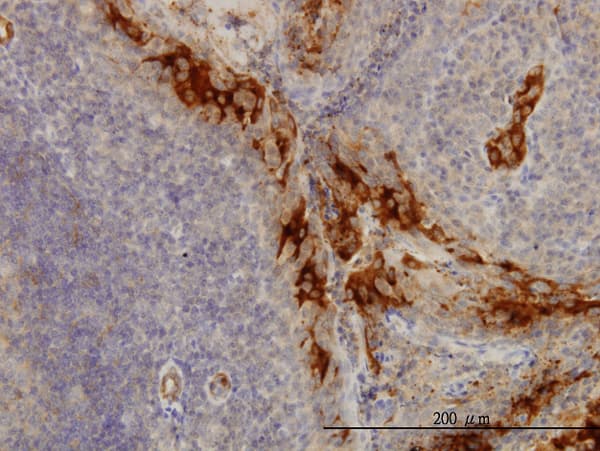 TNFRSF6B / DCR3 Antibody (clone 7G5)