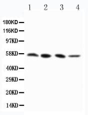 RIPK3 / RIP3 Antibody (aa60-76)