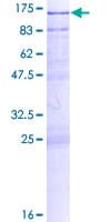 Human CLGN / Calmegin Protein (Recombinant GST)
