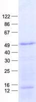 Human NEUROD4 Protein (Recombinant His, N-Terminal)
