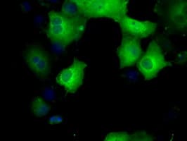 SORD / Sorbitol Dehydrogenase Antibody (clone OTI17E7)