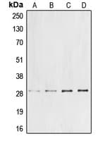CCNG1 / Cyclin G1 Antibody (Internal)