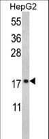 Polyclonal Rabbit anti-Human RPS15 / Ribosomal Protein S15 Antibody (aa1-30, IHC, WB)