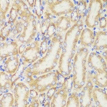 Polyclonal Rabbit anti-Human TOMM20 Antibody (IHC, IF)
