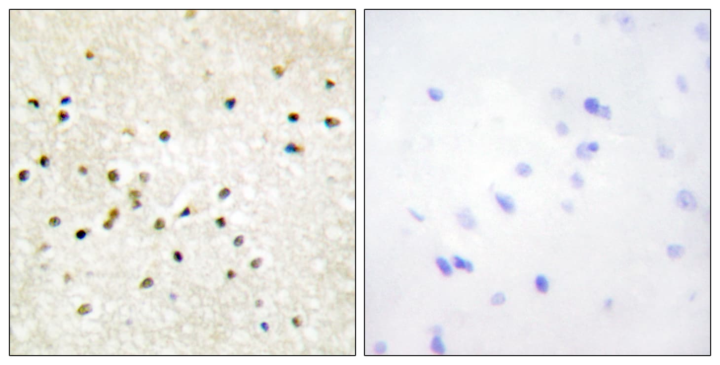TFB1 / GTF2H1 Antibody (aa15-64)