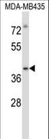 IRAK4 / IRAK-4 Antibody (aa422-449)