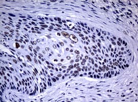 NBN / Nibrin Antibody (aa183-460, clone OTI3C12, Carrier-free)