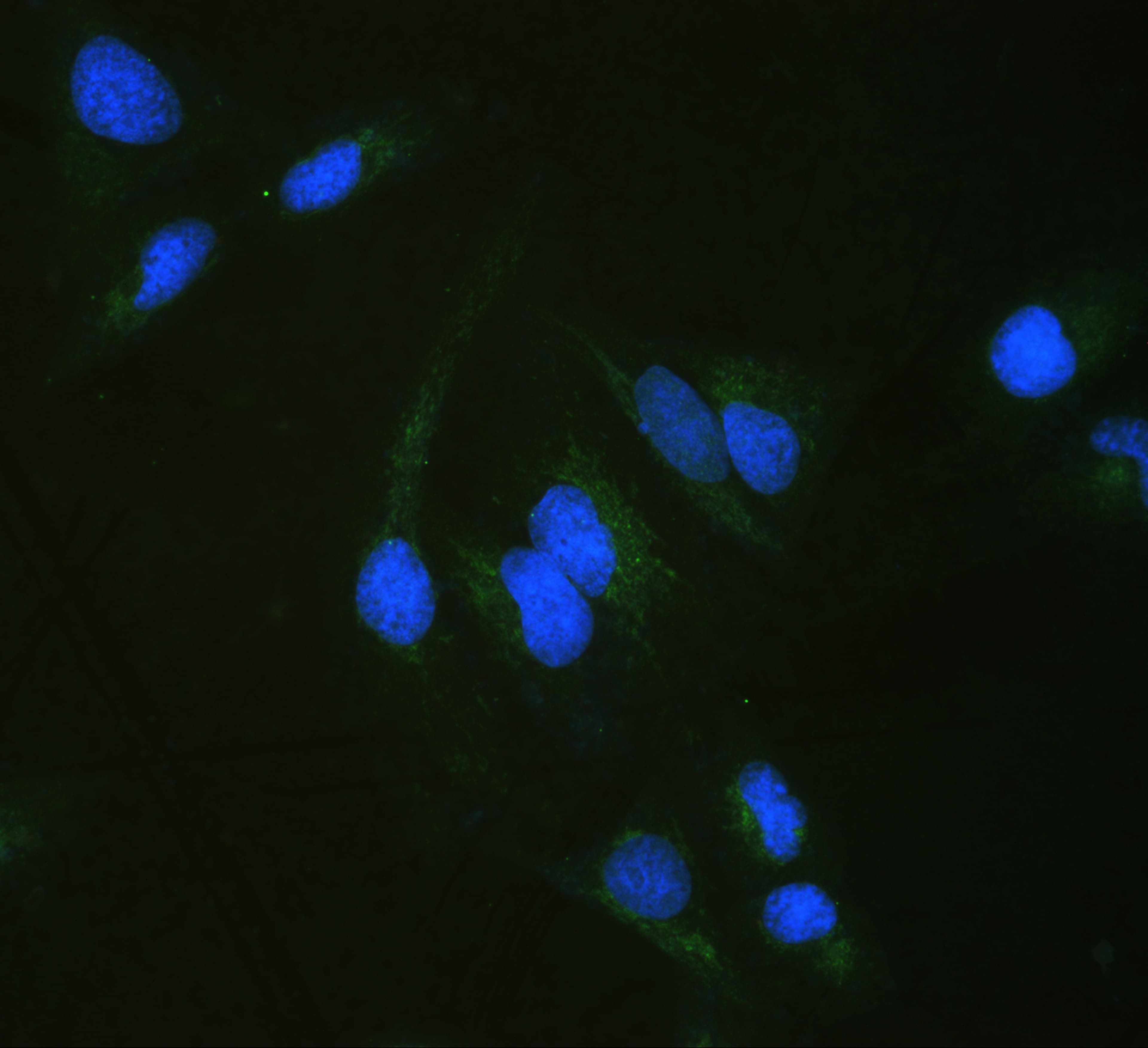 Polyclonal Rabbit anti-Human ALDH7A1 Antibody (IHC, WB)
