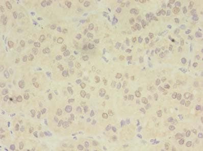 Polyclonal Rabbit anti-Human ZDHHC4 Antibody (IHC, WB)