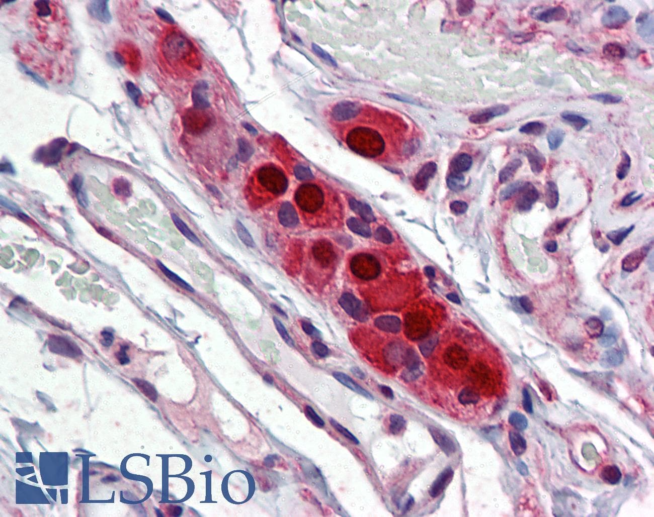 IHC-plus™ Monoclonal Mouse anti-Human ELAVL4 / HuD Antibody (clone 6B9, IHC, WB)