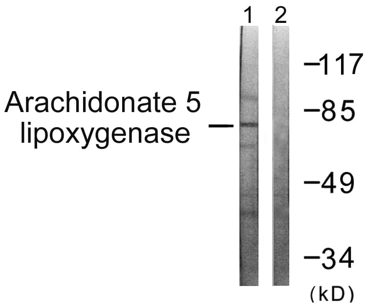 IHC-plus™ ALOX5 / 5-LOX Antibody (aa246-295)
