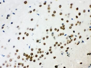 WNT2B Antibody