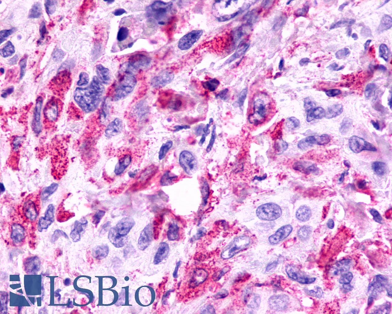 PathPlus™ Polyclonal Rabbit anti-Human FKSG80 / GPR81 Antibody (C-Terminus, IHC)