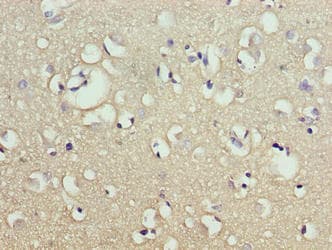 Polyclonal Rabbit anti-Human CNIH2 Antibody (IHC, WB)