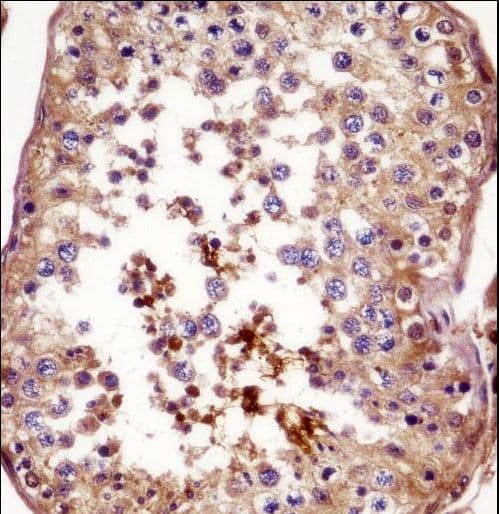 AKAP82 / AKAP4 Antibody (aa10-36)