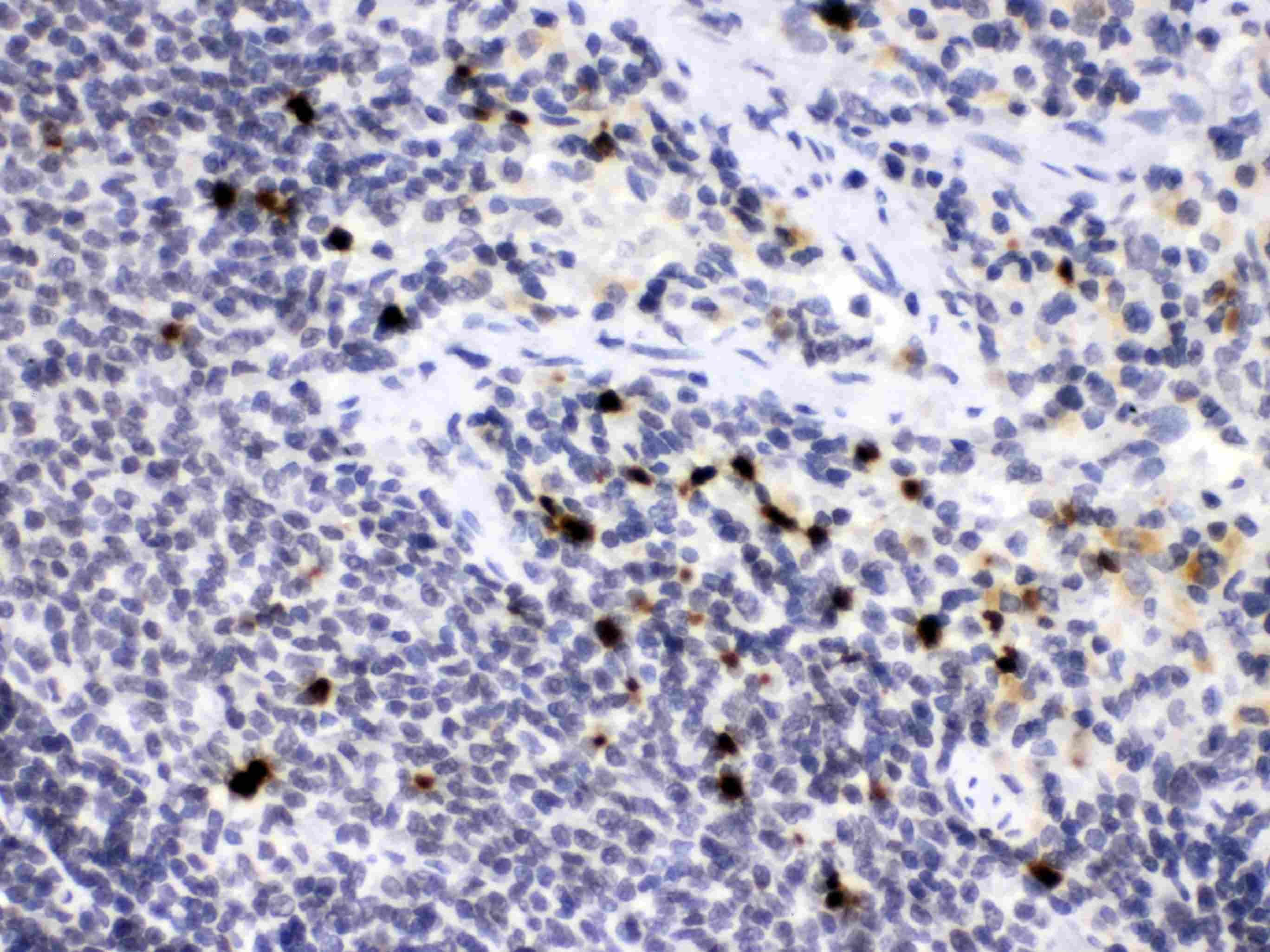 HNE / Neutrophil Elastase Antibody
