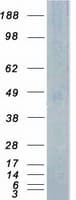 Human TSSK1B Protein (Recombinant Myc-DDK (Flag))