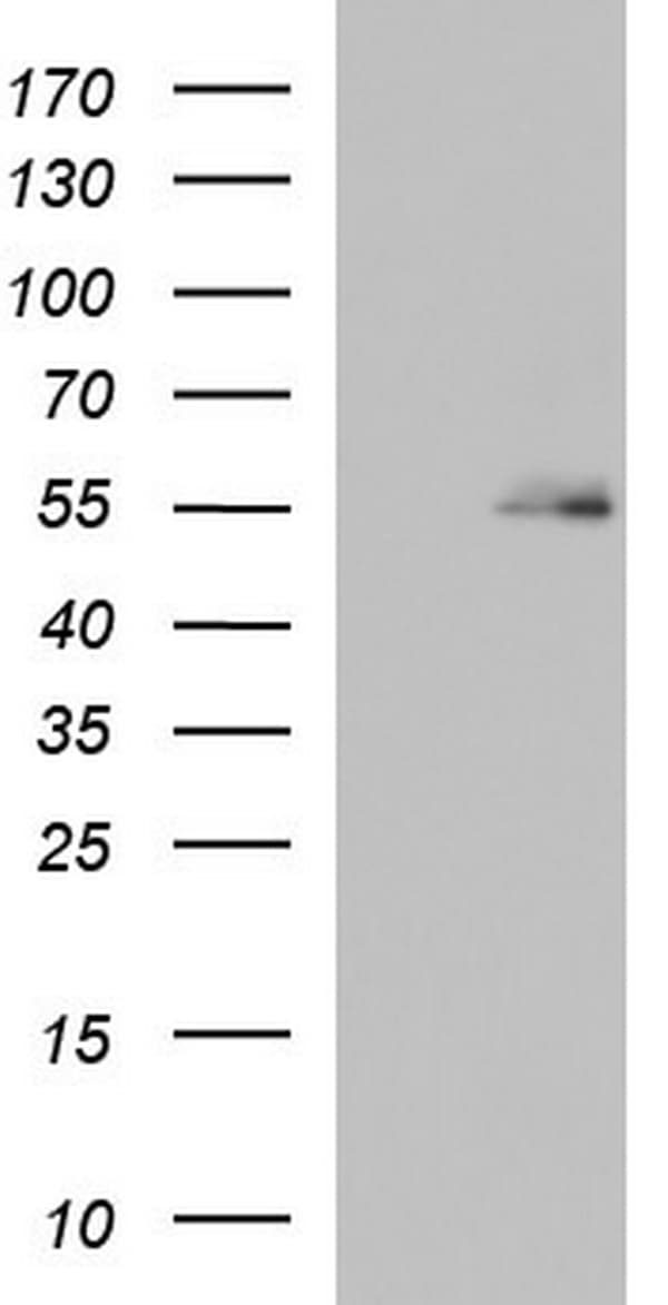 Monoclonal Mouse anti-Human BBS4 Antibody (clone OTI2D5, aa266-519, WB)