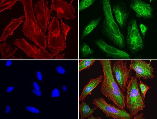 KRT7 / CK7 / Cytokeratin 7 Antibody (aa1-114, clone UMAB161, Carrier-free)