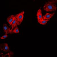 COL5A1 / Collagen V Alpha 1 Antibody (Internal)