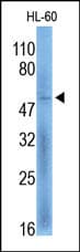 Polyclonal Rabbit anti-Human FLCN / Folliculin Antibody (WB)