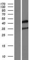 NR2E1 / TLX Protein (Over-Expression Lysate Myc-DDK (Flag))