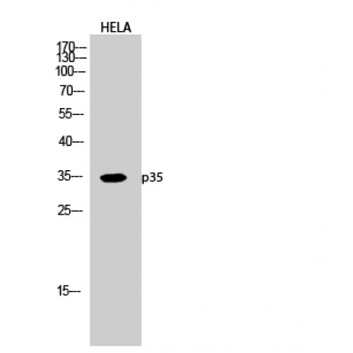 p35 Antibody (30-110 aa, N-terminal)