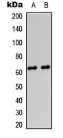 Polyclonal Rabbit anti-Human PRKAG2 / AMPK Gamma 2 Antibody (N-Terminus, IHC, IF, WB)
