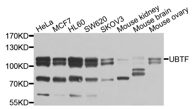 UBTF / UBF Antibody