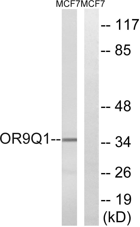 OR9Q1 Antibody (aa234-283)