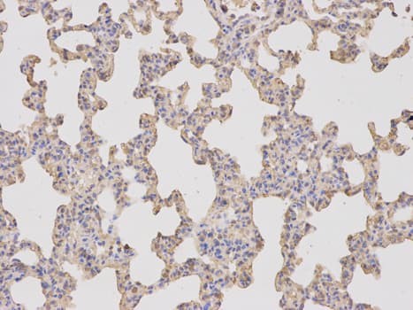 IHC-plus™ Polyclonal Rabbit anti-Human KLK1 / Kallikrein 1 Antibody (IHC, WB)