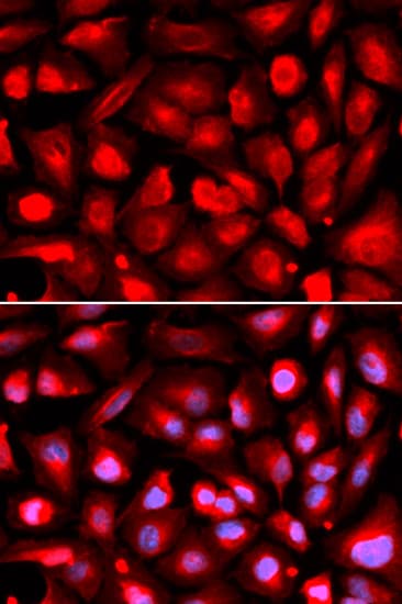 IHC-plus™ ETS1 / ETS-1 Antibody