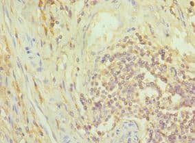 NCK1 / NCK Antibody (aa58-377)