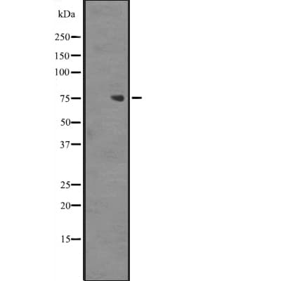 Polyclonal Rabbit anti-Human ZNF709 Antibody (IHC, WB)