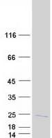 Human UBE2D3 / UBCH5C Protein (Recombinant Myc-DDK (Flag))