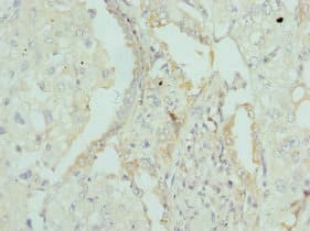 APOM / Apolipoprotein M Antibody