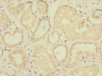 TAPBPL / TAPBPR Antibody