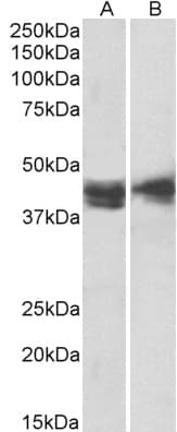 IHC-plus™ IL3RA / CD123 Antibody