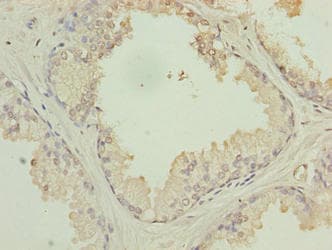 HACD2 / PTPLB Antibody